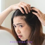 prevent hair loss
